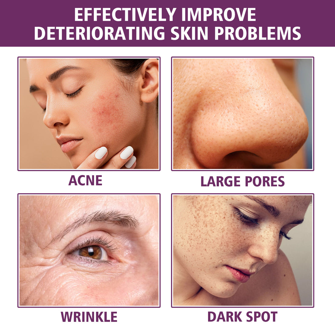 Niacinamide Serum dropper applicator