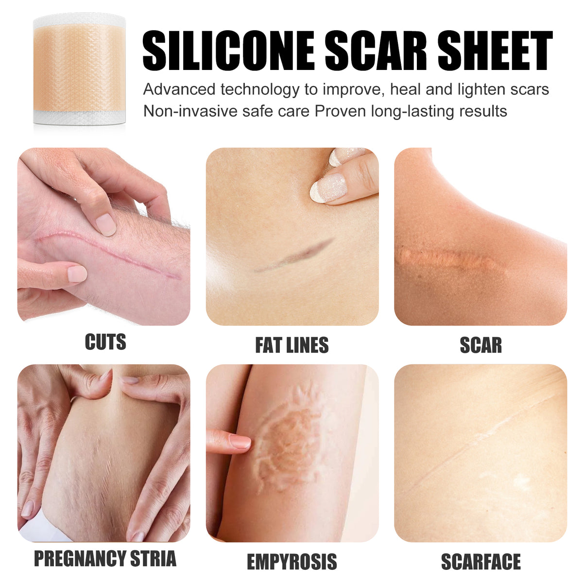 Silicone scar patch stored on its liner