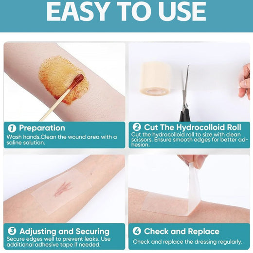 Hydrocolloid wound dressing