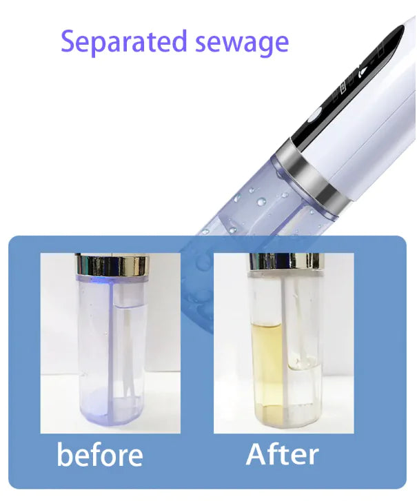 Rechargeable Blackhead Remover Vacuum — Adjustable Pore Cleaner - Image 1