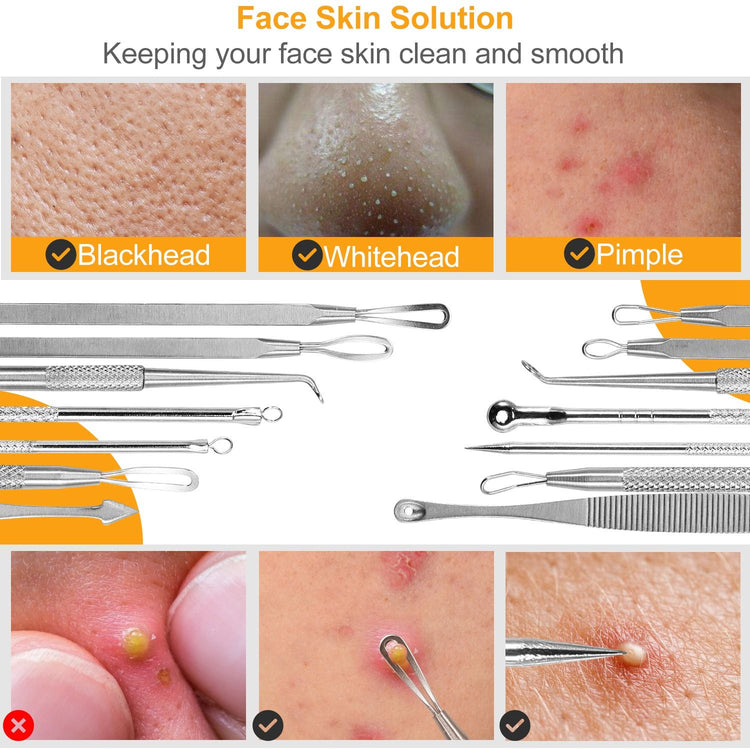 7-Piece Blackhead Extractor Kit detail view 1