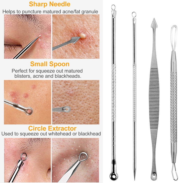 7-Piece Blackhead Extractor Kit detail view 3