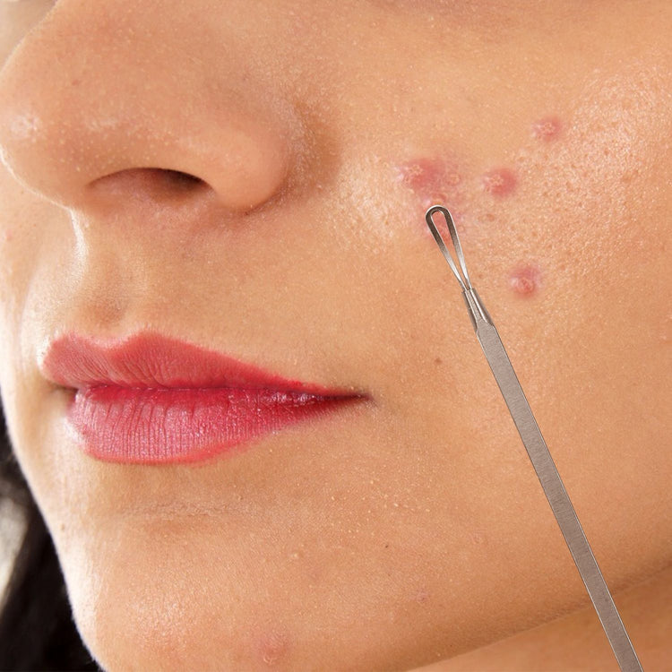 7-Piece Blackhead Extractor Kit detail view 9