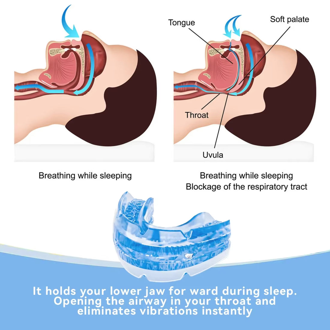 Anti-snoring mouthpiece with storage case