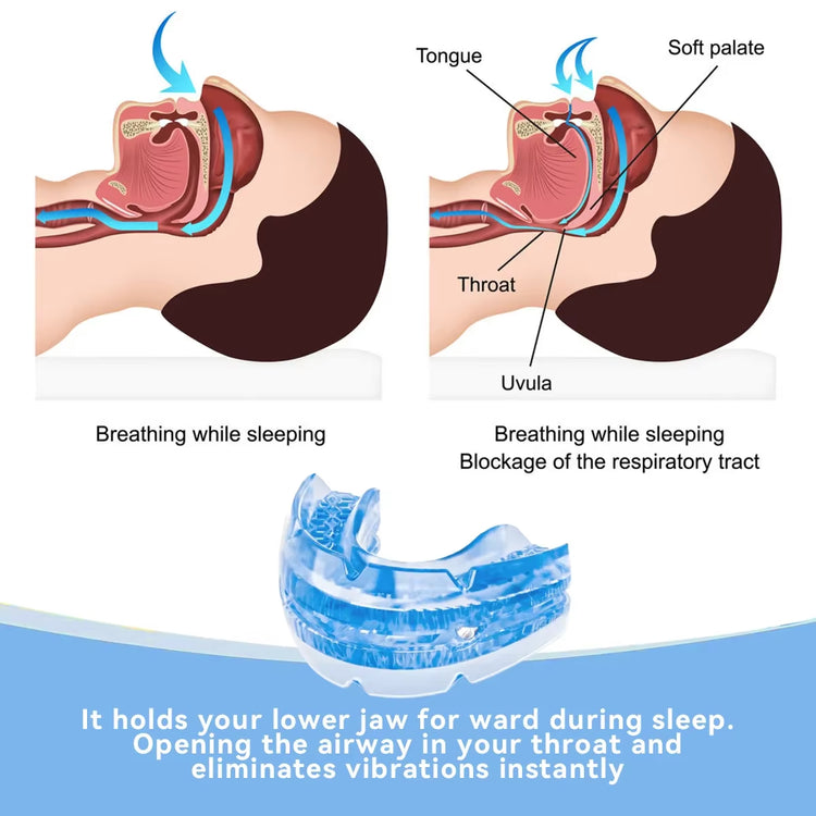 Anti-snoring mouthpiece with storage case