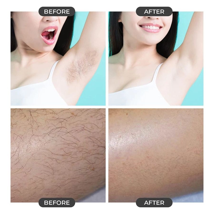 Crystal hair eraser grip detail