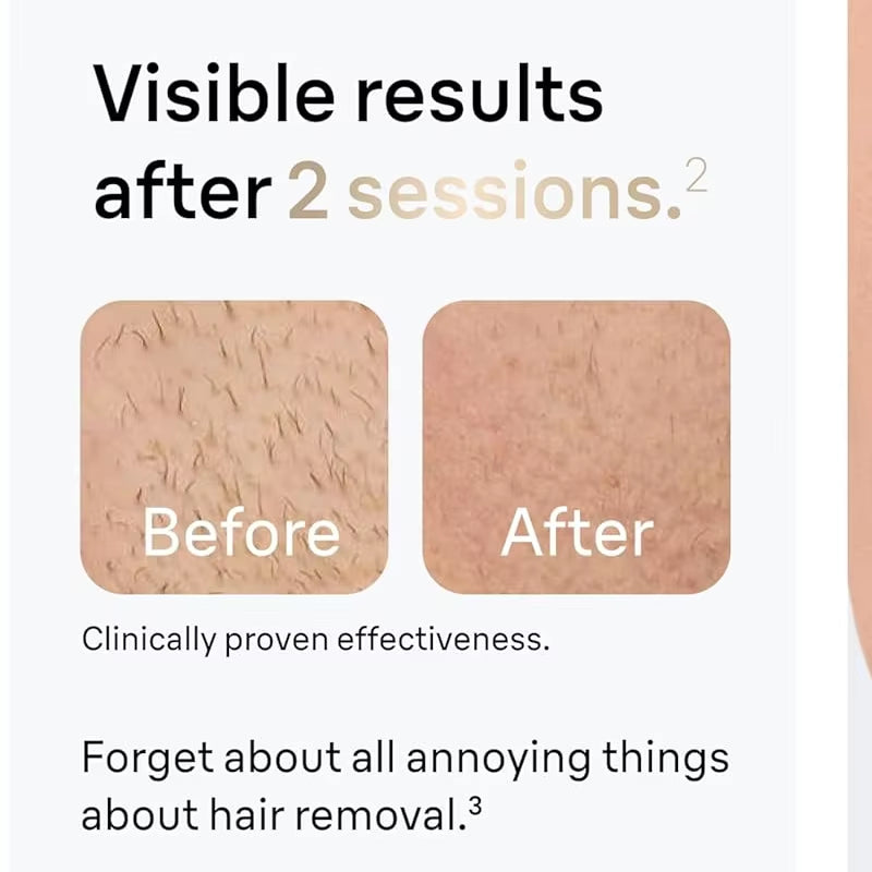 IPL hair removal device intensity setting display