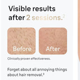 IPL hair removal device intensity setting display