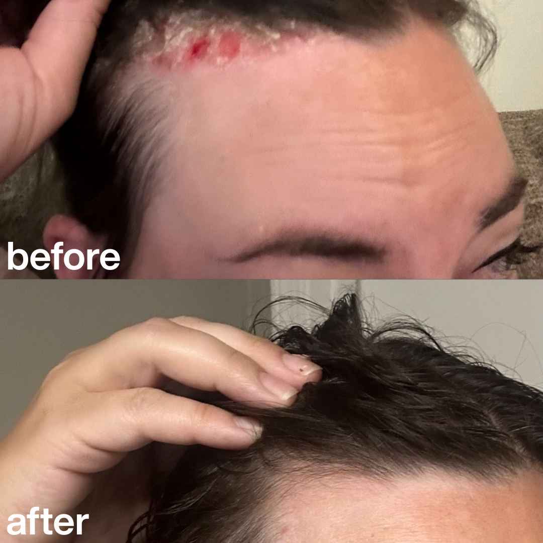 Scalp scrub applied to wet hair