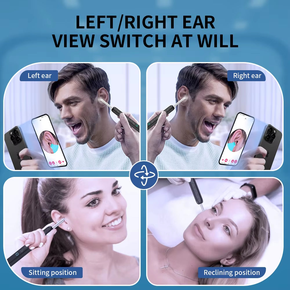 Ear wax camera connected to smartphone screen