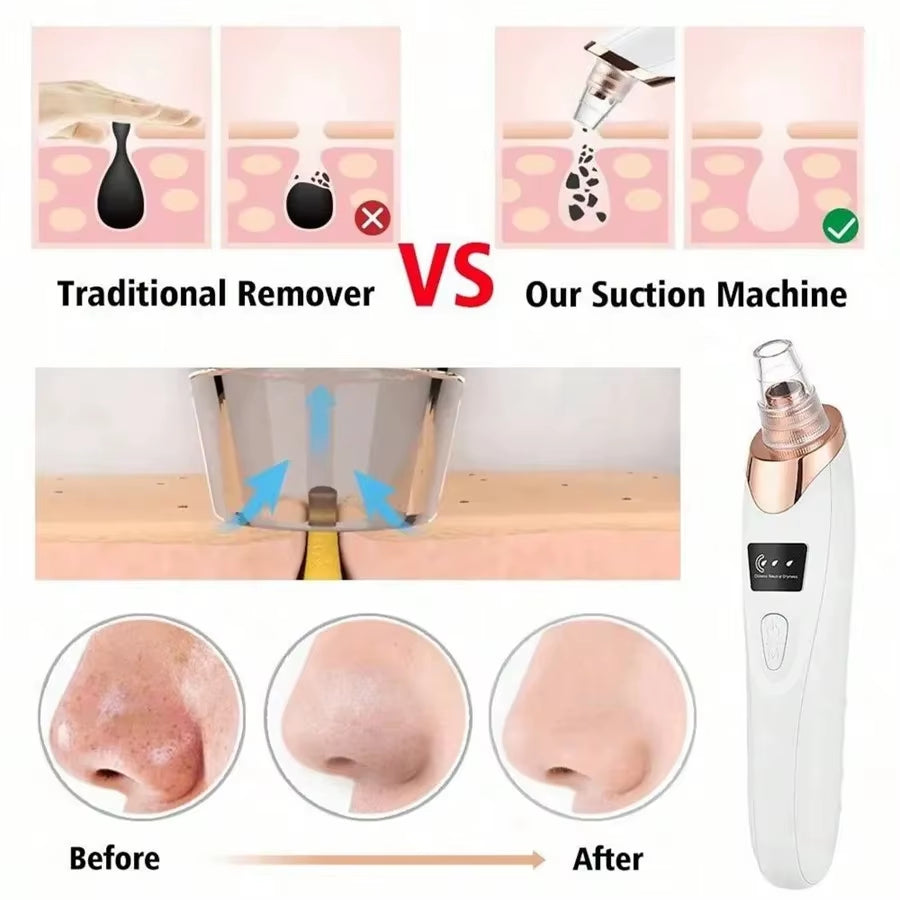 Electric Blackhead Remover Vacuum Cleaner - Facial Deep Cleansing Pore Cleaner for Black Spots Removal Skin Care Tools