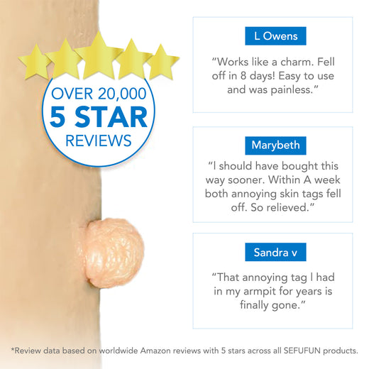Skin Tag Removal Tool Kit product image 2