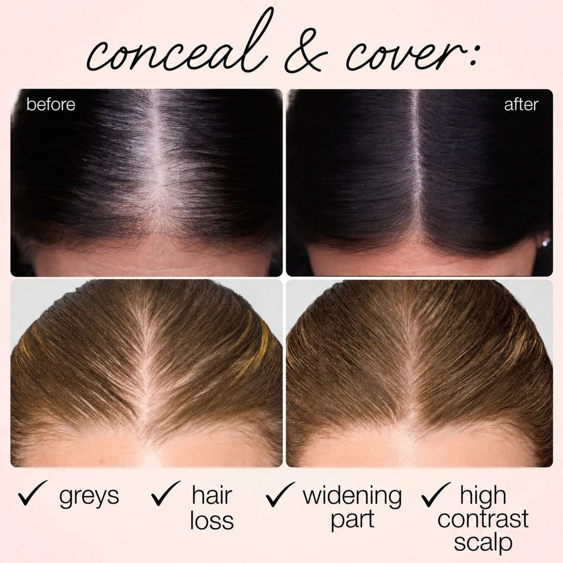 Refreshing and Non-Greasy Scalp Concealer