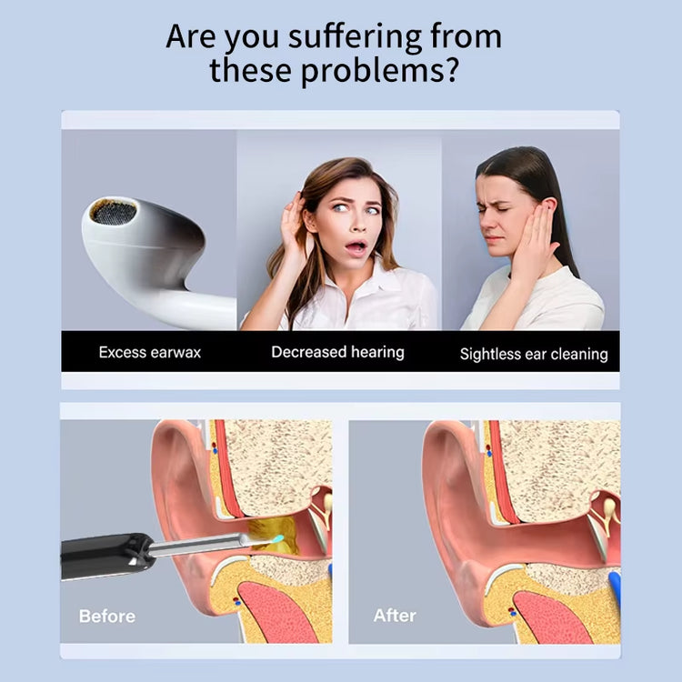 Benvoro Pro ear cleaning tool in use