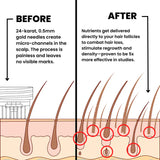 Long Micro-Needle Essence Serum product image 3