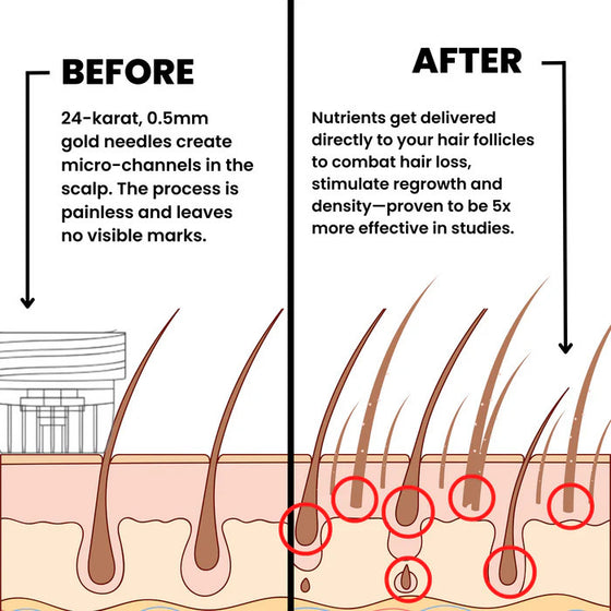 Long Micro-Needle Essence Serum product image 3