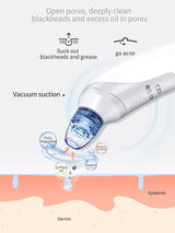 Pore vacuum tool side angle view