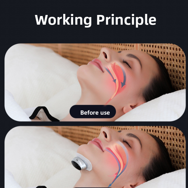 Wireless Throat Massager for Snoring Relief