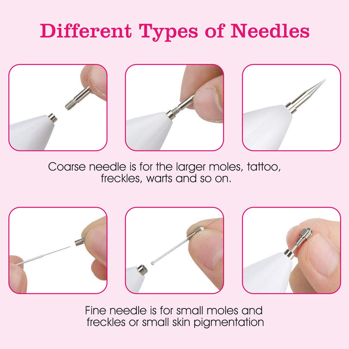 Portable skin tag repair kit needle heads