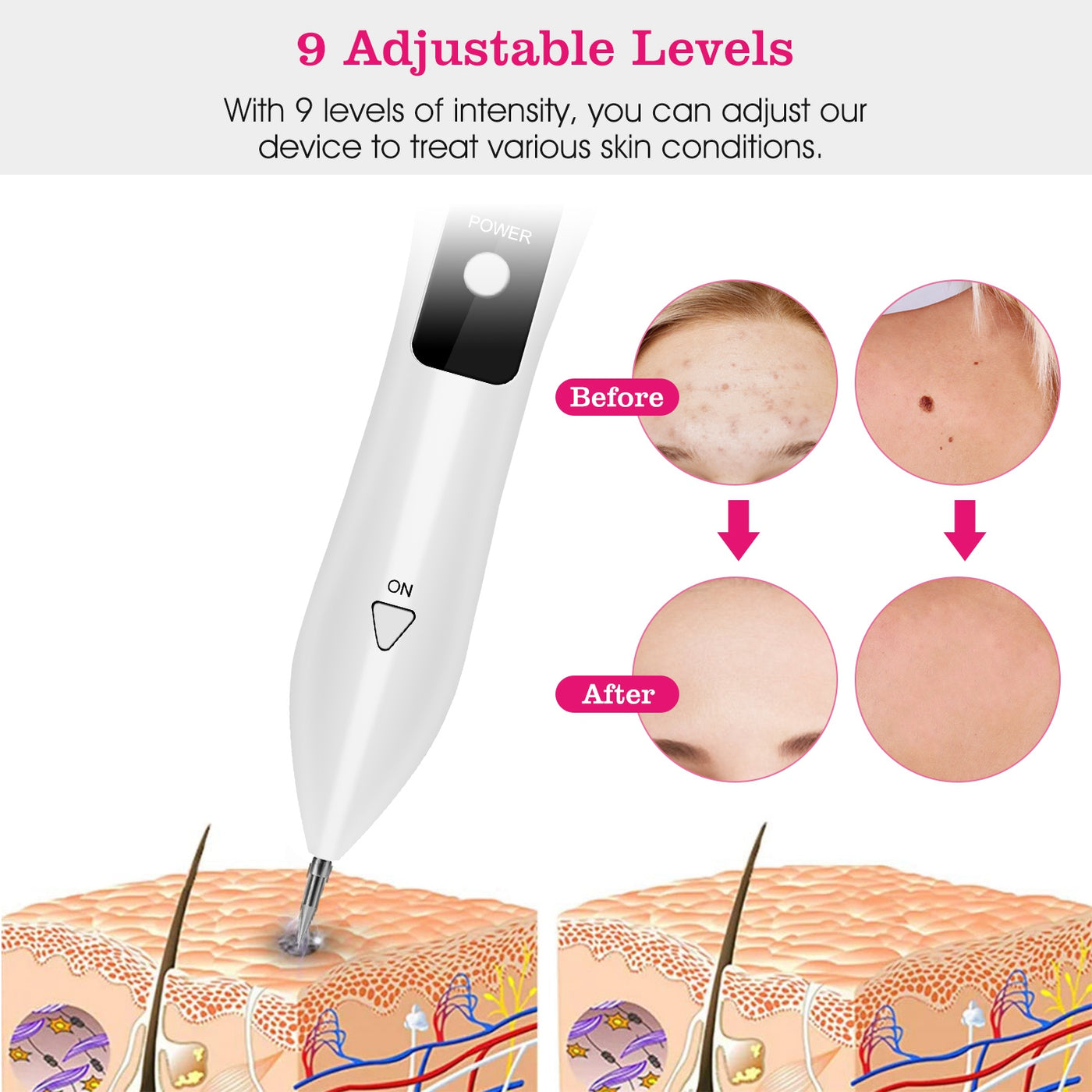 Portable skin tag repair kit accessory case